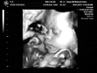 4D Beautiful Baby Scan - How To Conceive A Baby Boy